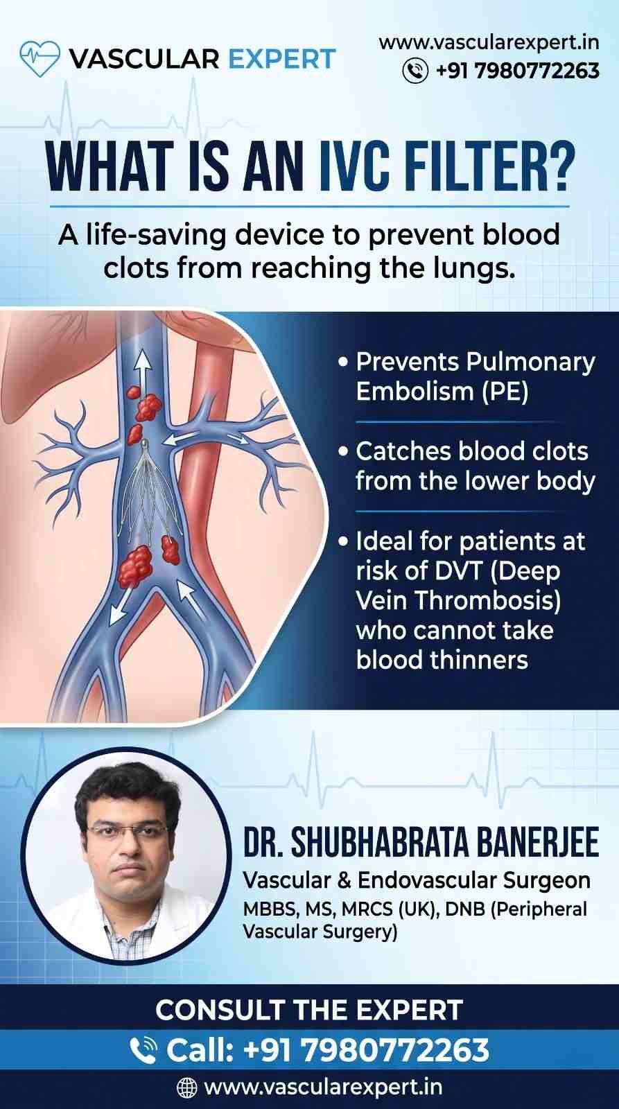 What is an IVC Filter? | Advanced DVT Treatment & Pulmonary Embolism Prevention in Kolkata